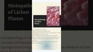 Living with Lichen Planus #shorts