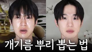 여름 못생김 & 여드름의 원인, 개기름 뿌리 뽑는 법 (실제 극복 경험)