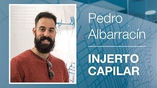 Injerto Capilar Pedro Albarracín | Experiencia Beyou