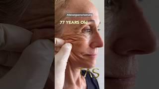 FACELIFT Extreme: 77-Jährige sieht aus wie 30? doc.rolf reacts