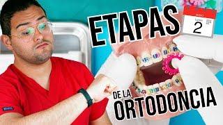 ETAPAS / FASES del tratamiento de BRACKETS ¿Cuanto TIEMPO DURA la ORTODONCIA?