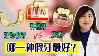 Removable Denture vs Dental Bridge vs Dental Implant l The Pros and Cons l Best False Teeth?