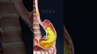 What happens in your body when you VOMIT?  Explained in 3D