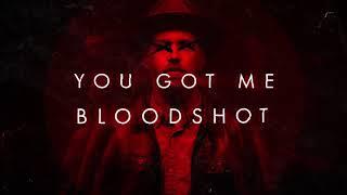 Sam Tinnesz - Bloodshot [Official Lyric Video]