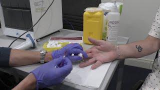 Hepatitis C Rapid Testing Demo