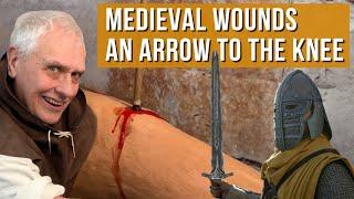 Medieval Wounds | What happens when you take an arrow to the knee?