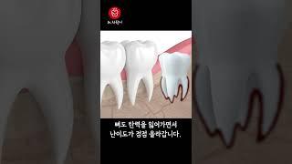 사랑니 빼기 가장 좋은 나이 #shorts