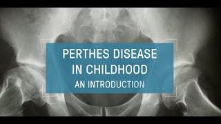 Perthes Disease in Childhood - An Introduction