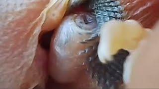 found nest in our garden with baby bird and have botfly in their skin video