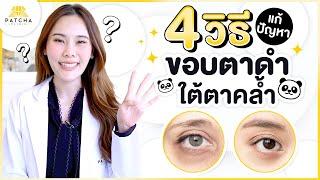 4 วิธีแก้ปัญหา ขอบตาดำ ใต้ตาคล้ำ ให้กลับมาดูสดใส