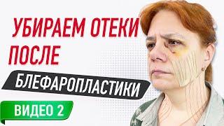  ТЕЙПИРОВАНИЕПОСЛЕ БЛЕФАРОПЛАСТИКИ / ВИДЕО 2 | Сания Абдрахманова | Учебный центр BBALANCE