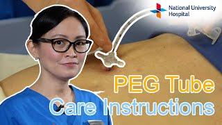 PEG Tube Care Instructions