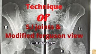 Technique of S.I joints & MFV (Ep-39) |Modified ferguson view | Sacroiliac Joint Oblique view