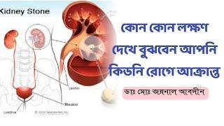 কোন কোন লক্ষণ দেখে বুঝবেন আপনি কিডনি রোগে আক্রান্ত | Dr. Md. Joynal Abdin
