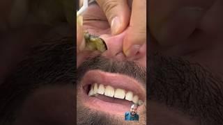  nose waxing for man's reaction  #nosewaxing#cutssaloon #mux9tvsalon #hairstyle