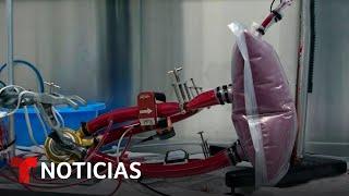 Corazón artificial sin válvulas aliviará a pacientes con insuficiencia cardiaca | Noticias Telemundo