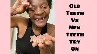 #dentures #whoisshonda #drheavenly New dentures vs old dentures try on