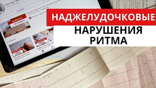 ЭКГ диагностика аритмий. Наджелудочковые (предсердные) тахикардии.