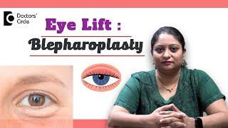 Eyelid Surgery for Under Eye Bags | Blepharoplasty #antiaging  - Dr. Ramya Deepthi | Doctors' Circle