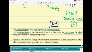 Colorectal cancer clinical case and Duke criteria