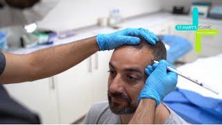 Experiencing the Hair Transplant Procedure | St Mary's Hair Clinic