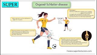 Osgood Schlatter disease: Most Important Points for USMLE & NEET