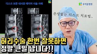 손상없는 디스크 치료법 강의영상 | 누구나 보고 배울수 있게 공개합니다 / 우리들병원TV