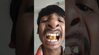 Super Sour" Nobel Super Soda Candy ASMR chocolate #toton #funny #comedy #subscribe #shorts