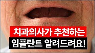 다양한 임플란트 종류ㅣ임플란트 치과의사가 추천하는 임플란트는?