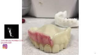 The Progression of Denture Technologies Featuring Solutions from Keystone Industries