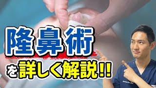 鼻整形したい人は知っておくべき隆鼻術について解説