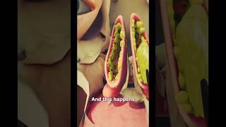 Cholesterol Animation, Medical Animation, Amerra Medical Visualization, patient education, medical.