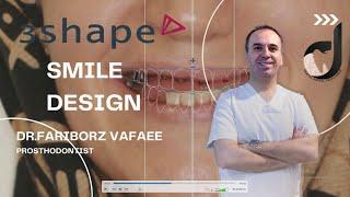 Smile design tutorial in 3shape unite (part2)