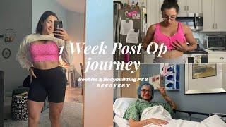 1 *FULL* Week POST-OP Recovery | Breast augmentation + Bodybuilding Pt. 2