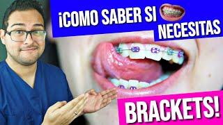 ¡COMO saber si necesito BRACKETS!  GUÍA PRACTICA 2019  #ORTODONCIA