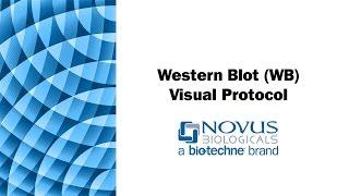 Western Blot (WB) Visual Protocol