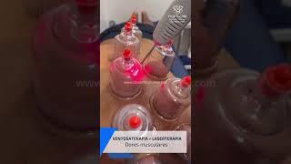 Terapia combinada para alívio de dor muscular - Ventosas e Laserterapia #dor #fisioterapia #saude