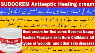 Sudocrem antiseptic healing cream  | Nappy Rashes cream | baby rashes cream | fast rashes healing