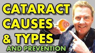 WHAT CAUSES CATARACT & HOW TO PREVENT CATARACTS: youtube eye doctor optometrist explains