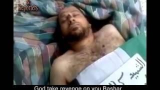 Syria, Hama Kamal Salqini was shot by Assad's snipers in Qusoor area  18 7 2012