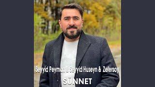 Sünnet