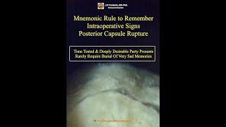 Posterior Capsule Rupture. Mnemonic Rule.