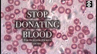 An elevated hematocrit level on TRT does not require blood donation