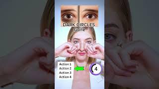 Dark circles Gone | Face Fitness, Facial Fitness, Facial Yoga