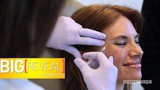 3 Women Try Botox For The First Time