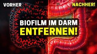 Biofilm & Candida im Darm: Wie Thymian & Oregano Öl deine Darmgesundheit revolutionieren!