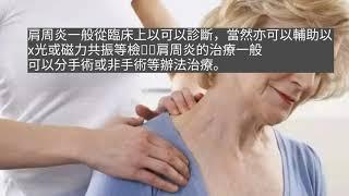 張民冠醫生大眾更了解骨科：各種病情