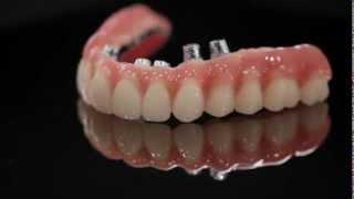 K Dental Lab Implant-2.mov