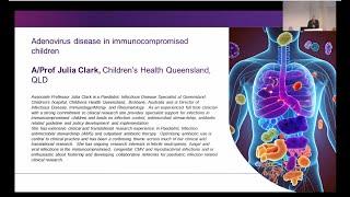 Adenovirus disease in immunocompromised children A/Prof Julia Clark