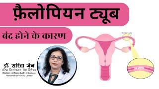 Tubal Factors of Infertility || फ़ैलोपियन ट्यूब बंद होने के कारण || Dr Sarita jain #ivf